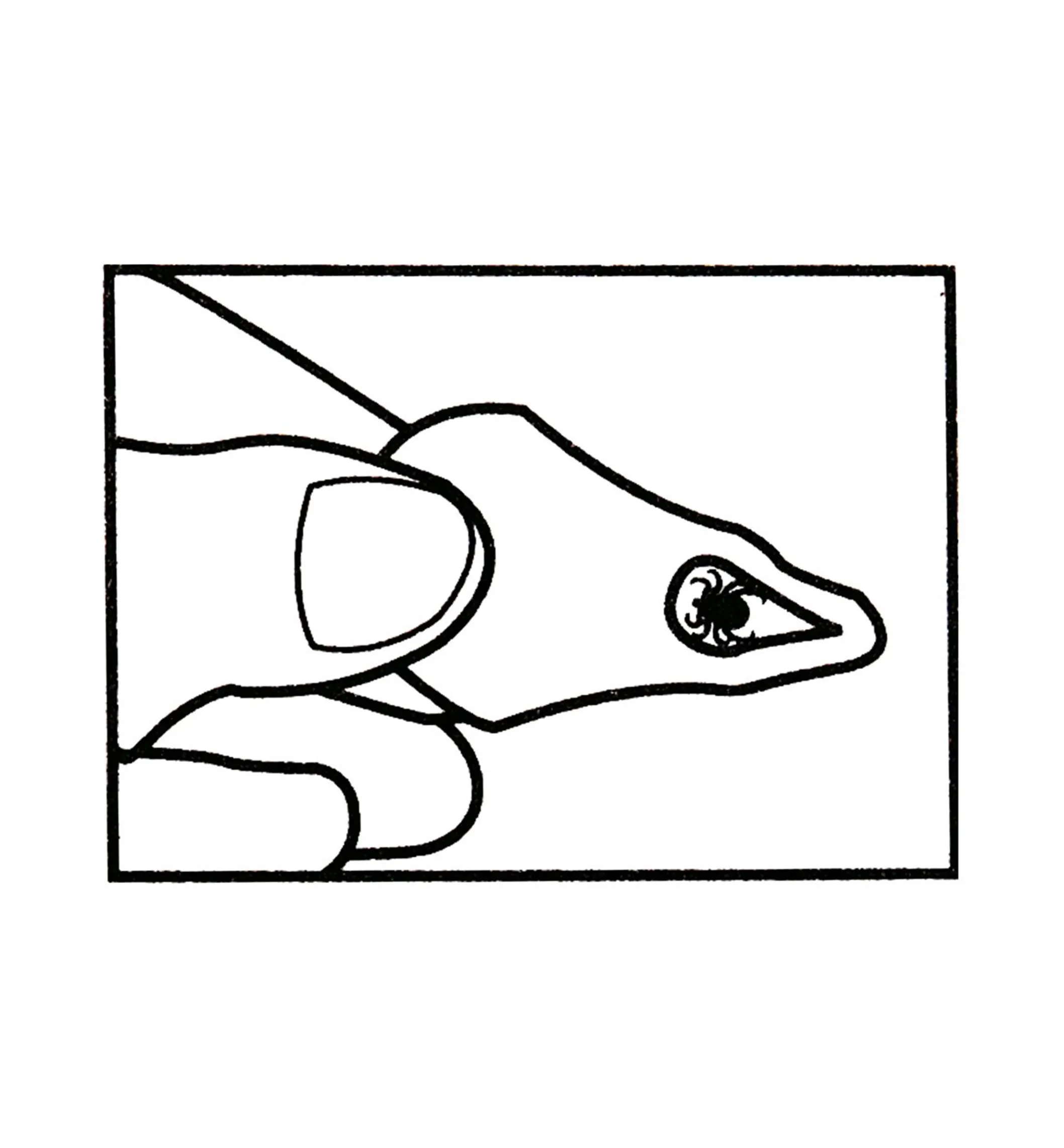 Tick Key Tick Remover